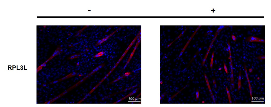 Figure mettant en évidence que la surexpression de la protéine ribosomale RPL3L réduit la croissance des myotubes.